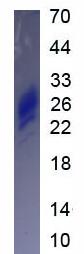 Active Interleukin 7 (IL7)