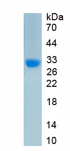 Active Kallikrein 6 (KLK6)