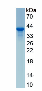 Active Fibroblast Growth Factor 23 (FGF23)