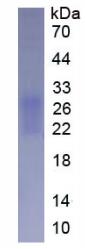 Active Programmed Cell Death Protein 1 (PD1)