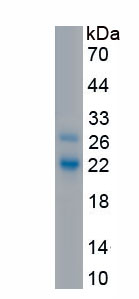 Active Programmed Cell Death Protein 1 (PD1)