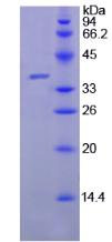 Active Lactoferrin (LTF)