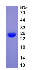 Active C Reactive Protein (CRP)