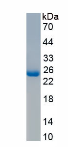 Active C Reactive Protein (CRP)