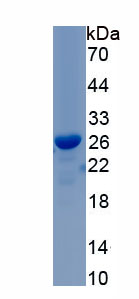 Active Prolactin (PRL)