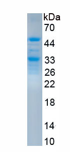 Active Receptor Activator Of Nuclear Factor Kappa B Ligand (RANkL)