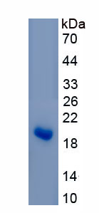 Active Endothelial NOS (eNOS)