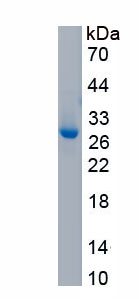 Active Carbonic Anhydrase I (CA1)