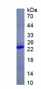 Active Superoxide Dismutase 2, Mitochondrial (SOD2)