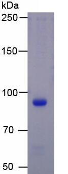 Active Bone Sialoprotein (BSP)