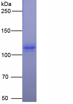 Active Transferrin Receptor (TFR)