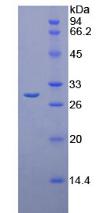 Active Chymotrypsin C (CTRC)