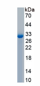 Active Lipopolysaccharide Binding Protein (LBP)