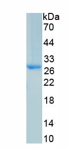 Active Lipopolysaccharide Binding Protein (LBP)