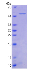 Active Tumor Necrosis Factor Receptor Superfamily, Member 1B (TNFRSF1B)