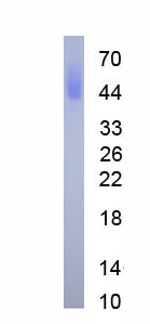 Active Cluster Of Differentiation 147 (C<b>D147</b>)