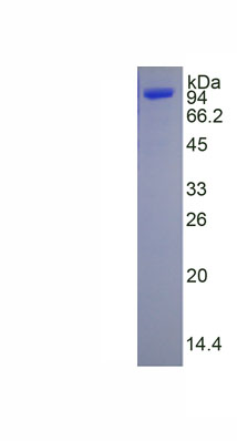 Active Transglutaminase 2 (TGM2)