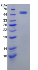 Active Receptor Tyrosine Protein Kinase erbB-2 (ErbB2)