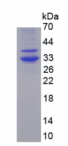 Active Hepcidin (Hepc)