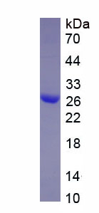 Active Interleukin 34 (IL34)