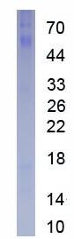 Active Ki-67 Protein (Ki-67)