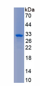 Active V-Erb B2 Erythroblastic Leukemia Viral Oncogene Homolog 3 (ErbB3)