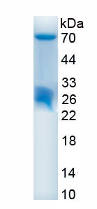 Active Histone Deacetylase 1 (HDAC1)