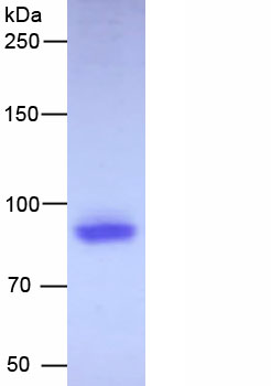 Active Amine Oxidase, Copper Containing 3 (AOC3)