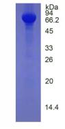 Active Histidine Rich Glycoprotein (HRG)