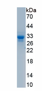 Active Janus Kinase 1 (JAK1)