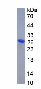 Active Fibulin 2 (FBLN2)