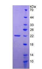 Active Tumor Necrosis Factor Receptor Superfamily, Member 14 (TNFRSF14)