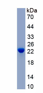 Active Ephrin A2 (EFNA2)