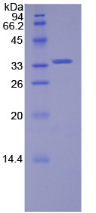 Active Spleen Tyrosine Kinase (SYK)