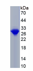 Active Sphingosine 1 Phosphate Lyase 1 (SGPL1)