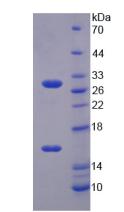 Active Sirtuin 3 (SIRT3)