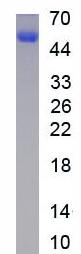 Active Carboxylesterase 2 (CES2)