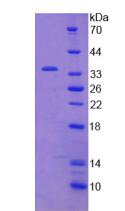 Active Janus Kinase 2 (JAK2)