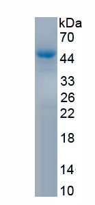 Active Mdm2 p53 Binding Protein Homolog (MDM2)