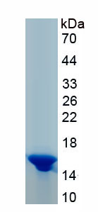 Active Melanoma Inhibitory Activity Protein 1 (MIA1)