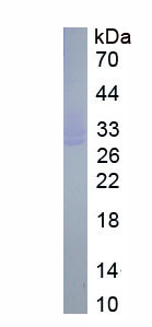 Active DNA Methyltransferase 3B (DNMT3B)