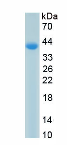 Active Interferon Gamma Receptor 2 (IFNgR2)