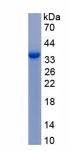 Active Angiopoietin Like Protein 7 (ANGPTL7)