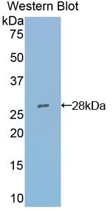 Anti-Actin Alpha 2, Smooth Muscle (ACTa2) Polyclonal Antibody