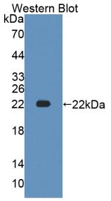 Anti-ATPase, Na+/K+ Transporting Alpha 1 Polypeptide (ATP1a1) Polyclonal Antibody