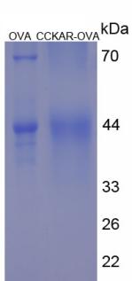 OVA Conjugated Cholecystokinin A Receptor (CCKAR)