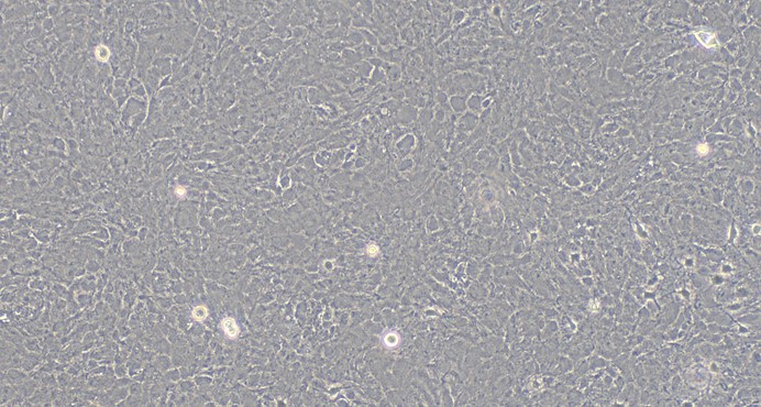 Primary Mouse Brain Astrocytes (BA)