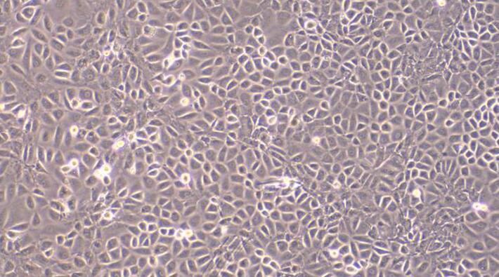 Primary Rat Brain Microvascular Endothelial Cells (BMEC)