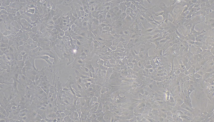 Primary Mouse Choroid Plexus Epithelial Cells (CPEC)