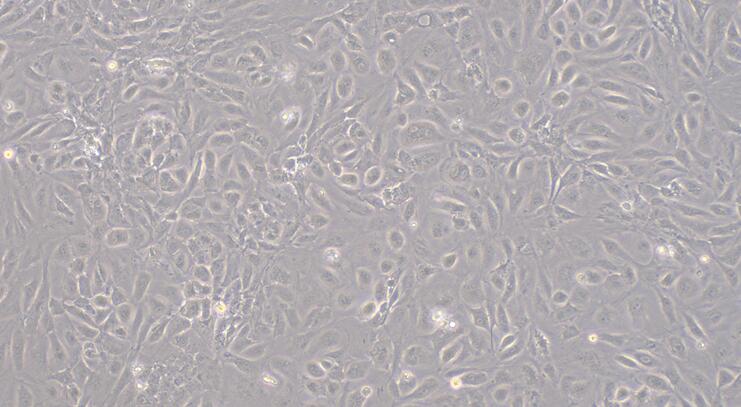 Primary Rabbit Umbilical Vein Endothelial Cells (UVEC)